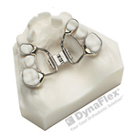 palatal expander - Wonder West Orthodontics in London ON