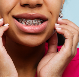 Orthodontic braces correcting common bite problems at Wonder West Orthodontics