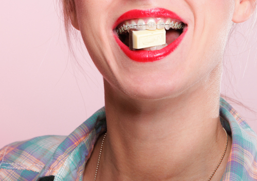 The five worst candies to eat during orthodontic treatment