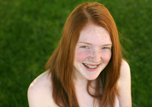 Helpful Hints for Dealing with Braces Pain