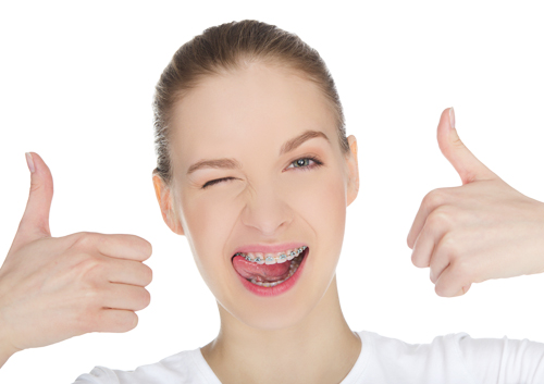 Five fun ways to countdown your braces time